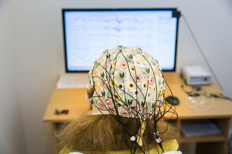 HSE — Mapping the Brain's Potential Illustration for news: HSE — Mapping the Brain's Potential