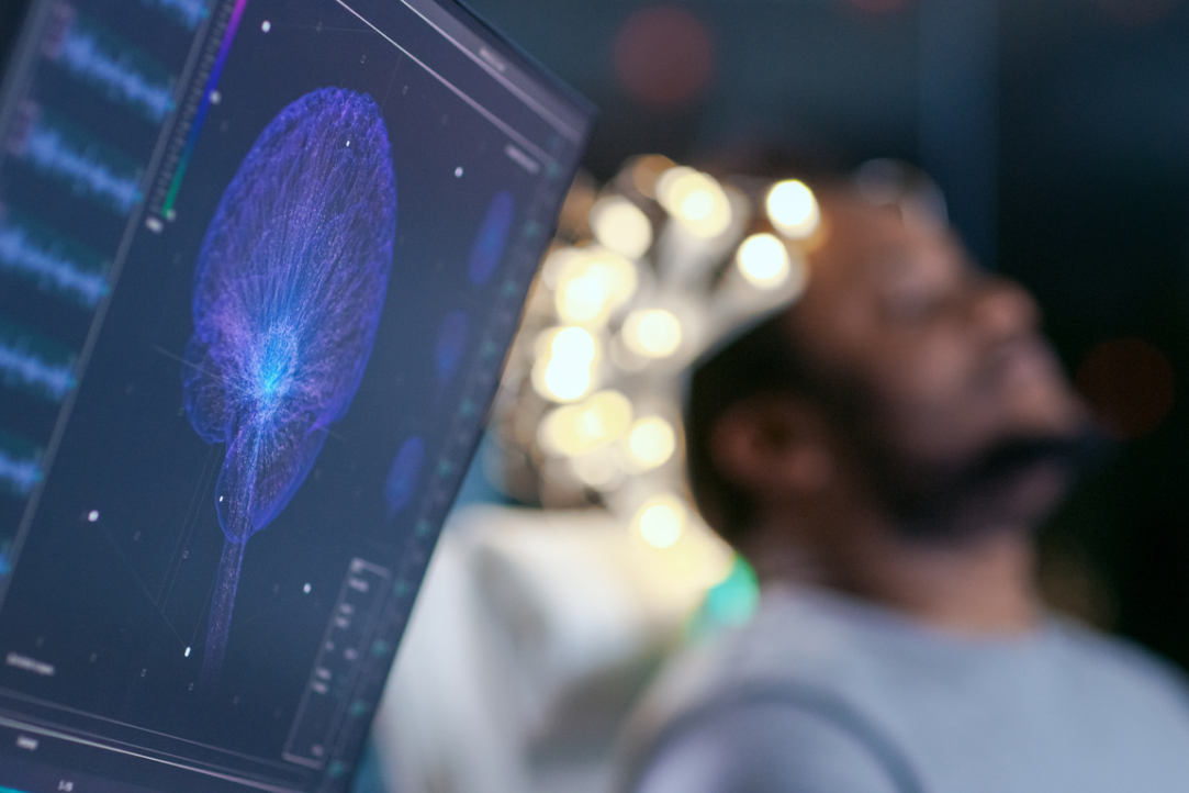 Researchers Expand the Capabilities of Magnetoencephalography Illustration for news: Researchers Expand the Capabilities of Magnetoencephalography